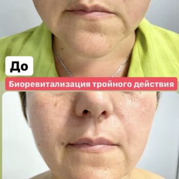 Наталія Бутенко, Полтава Фото - 52