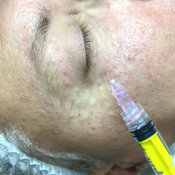 Наталія Бутенко, Полтава Фото - 53