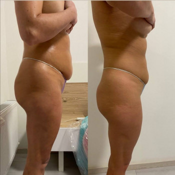 ВЛАЖНЫЕ "ВИСКИ" - ПЕЛЕНАНИЯ STYX
                    Косметолог Светлана Днепр