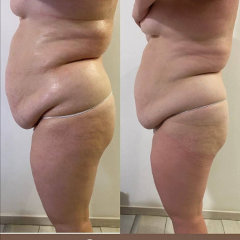 ВЛАЖНЫЕ "ВИСКИ" - ПЕЛЕНАНИЯ STYX
                    Косметолог Светлана Днепр