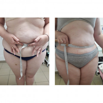 Оксана Білик, Львов Фото - 8