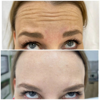 Beautymed Clinic, Запоріжжя Фото - 47