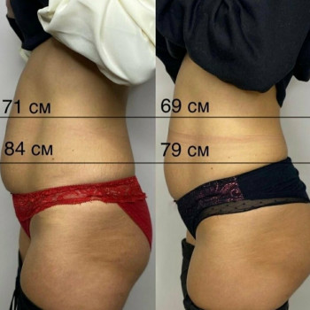 Ліполітики
                    Косметолог Оля Тернопіль