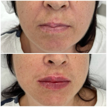 Берусь за «важкі»випадки