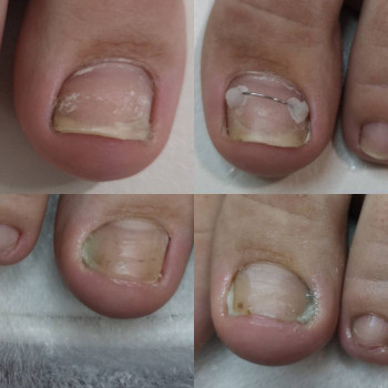 Установка КС