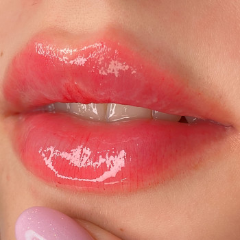 Контурная пластика