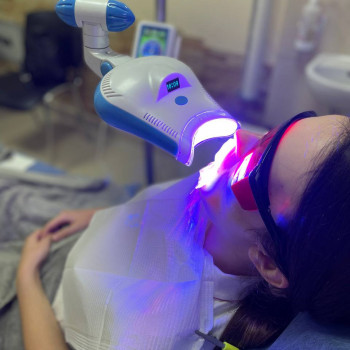 Відбілювання зубів сучасною системою Magic Smile