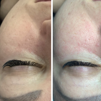 Діамантове шліфування