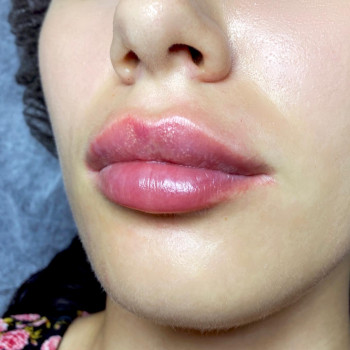 Алекс Слюсар, Черкаси Фото - 1