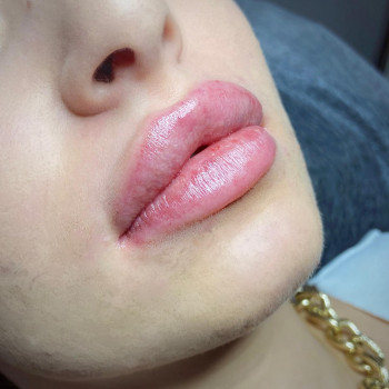 Алекс Слюсар, Черкаси Фото - 8