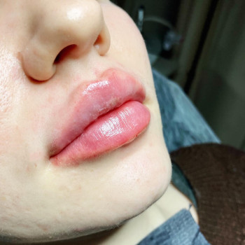 Алекс Слюсар, Черкаси Фото - 5