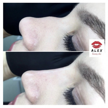 Алекс Слюсар, Черкаси Фото - 11