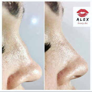 Алекс Слюсар, Черкаси Фото - 12