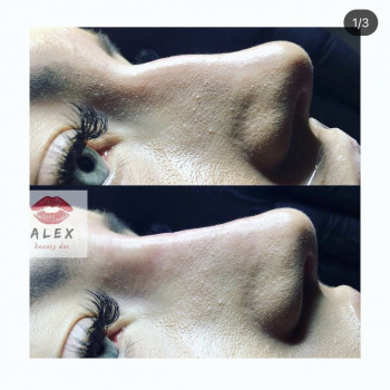 Алекс Слюсар, Черкаси Фото - 14