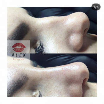 Алекс Слюсар, Черкаси Фото - 16