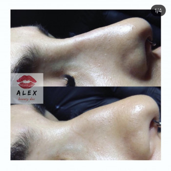 Алекс Слюсар, Черкаси Фото - 17