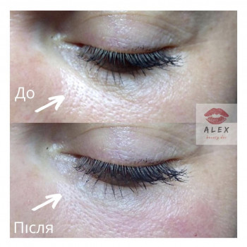 Алекс Слюсар, Черкаси Фото - 23