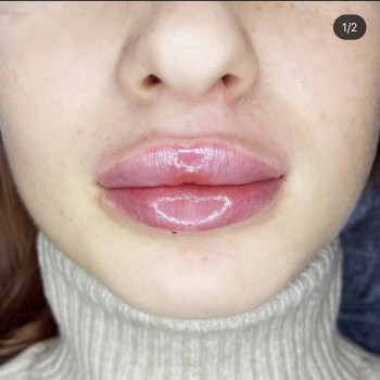 Алекс Слюсар, Черкаси Фото - 25