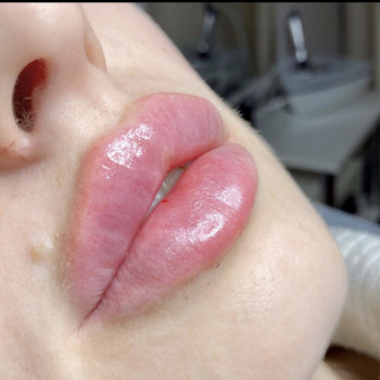 Алекс Слюсар, Черкаси Фото - 28