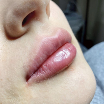 Алекс Слюсар, Черкаси Фото - 29