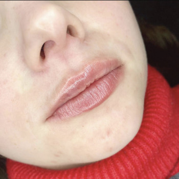 Алекс Слюсар, Черкаси Фото - 35