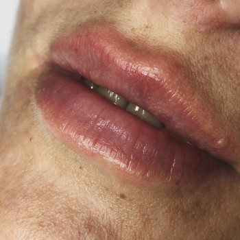 AVE EVA BEAUTY CLINIC, Бровари Фото - 17