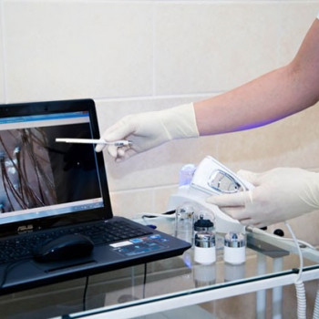 Діагностика захворювання волосся