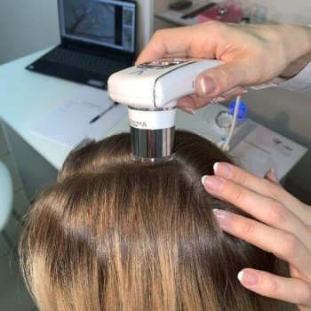 Діагностика захворювання волосся