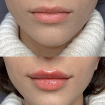 Катерина Колос, Київ Фото - 27