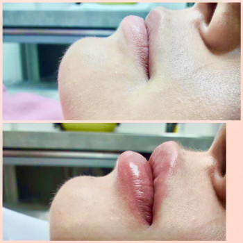 Катерина Колос, Київ Фото - 41