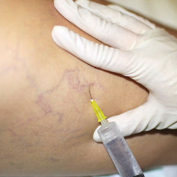 Катерина Колос, Київ Фото - 21