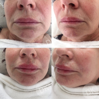 Катерина Колос, Київ Фото - 19