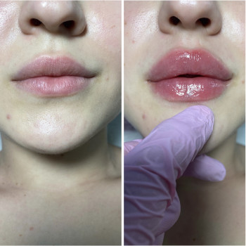 Виктория Попович, Харків Фото - 4