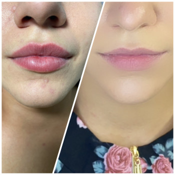 Виктория Попович, Харків Фото - 6