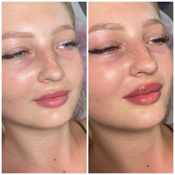 Виктория Попович, Харків Фото - 8