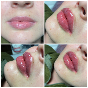 Виктория Попович, Харків Фото - 10