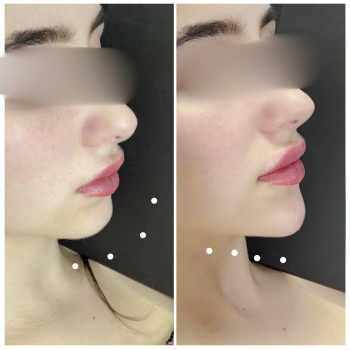 Алёна Ткаченко Ткаченко, Черкассы Фото - 14