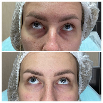 Алёна Ткаченко Ткаченко, Черкассы Фото - 12