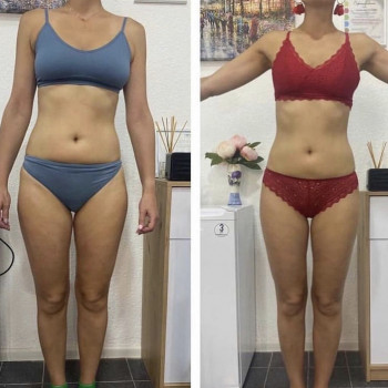 Вакуумный массаж
                    Косметолог Дарья Мариуполь