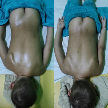 Мальчик 5 лет 
До /После 11 сеансов