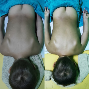 Мальчик 4 года 
До / после 10 сеансов