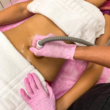 СМАС подтяжка живота