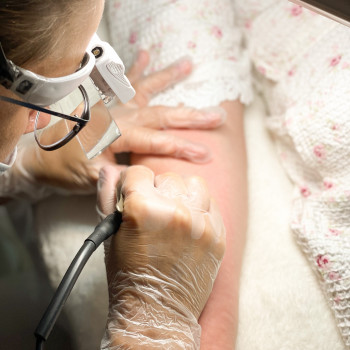 Электроэпиляция
                    Мастер депиляции Татьяна Мариуполь