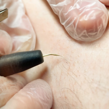 Электроэпиляция
                    Мастер депиляции Татьяна Мариуполь