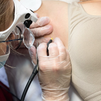 Электроэпиляция
                    Мастер депиляции Татьяна Мариуполь