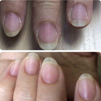 Алина Крикштанас, Кременчук Фото - 26