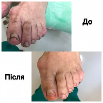 EOSC, Бровары Фото - 7