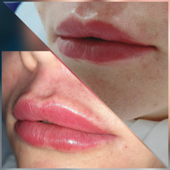 Татуаж губ увеличение, фото -  JULIA BEAUTY STUDIO