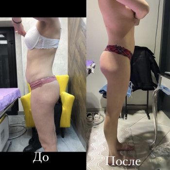 Альона Дидух, Вінниця Фото - 2