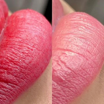 А вы знали, что свежая работа и зажившая отличаются??
• Сра